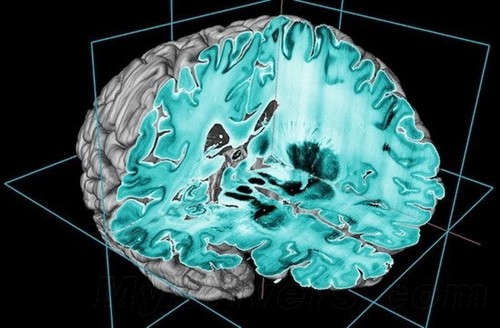 科学家获得迄今最清晰人体大脑3D图像 