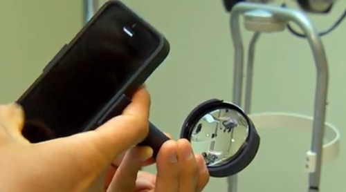 EyeGo可通过iPhone快速诊断眼部疾病！ 