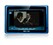�к�X2TV-KIT��ƷͼƬ5