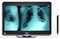 ����Latitude XT3(V845XT31CN)��ƷͼƬ4