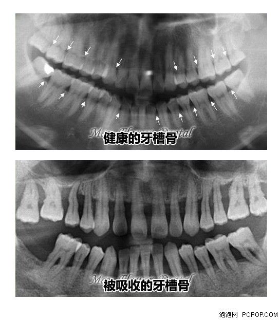读完就去看牙医吧关于牙齿的小知识