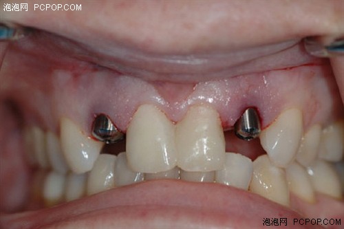 读完就去看牙医吧关于牙齿的小知识